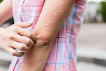 Comment utiliser un masque hydratant visage pour une peau douce et repulpée ?